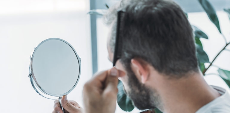 Ways to Look Good Even with Hair Loss